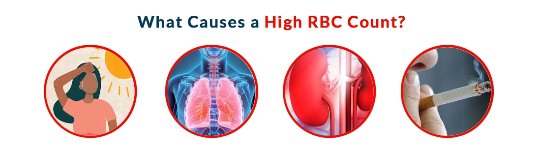 What Causes a High RBC Count